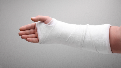 Picture of a broken arm in a cast